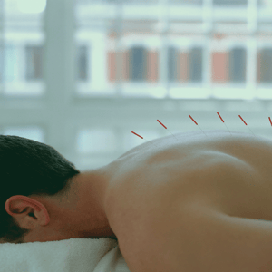 traitement-de-la-spasticite-post-avc-par-l-acupuncture