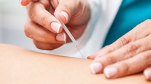 acupuncture-and-integrative-oncology