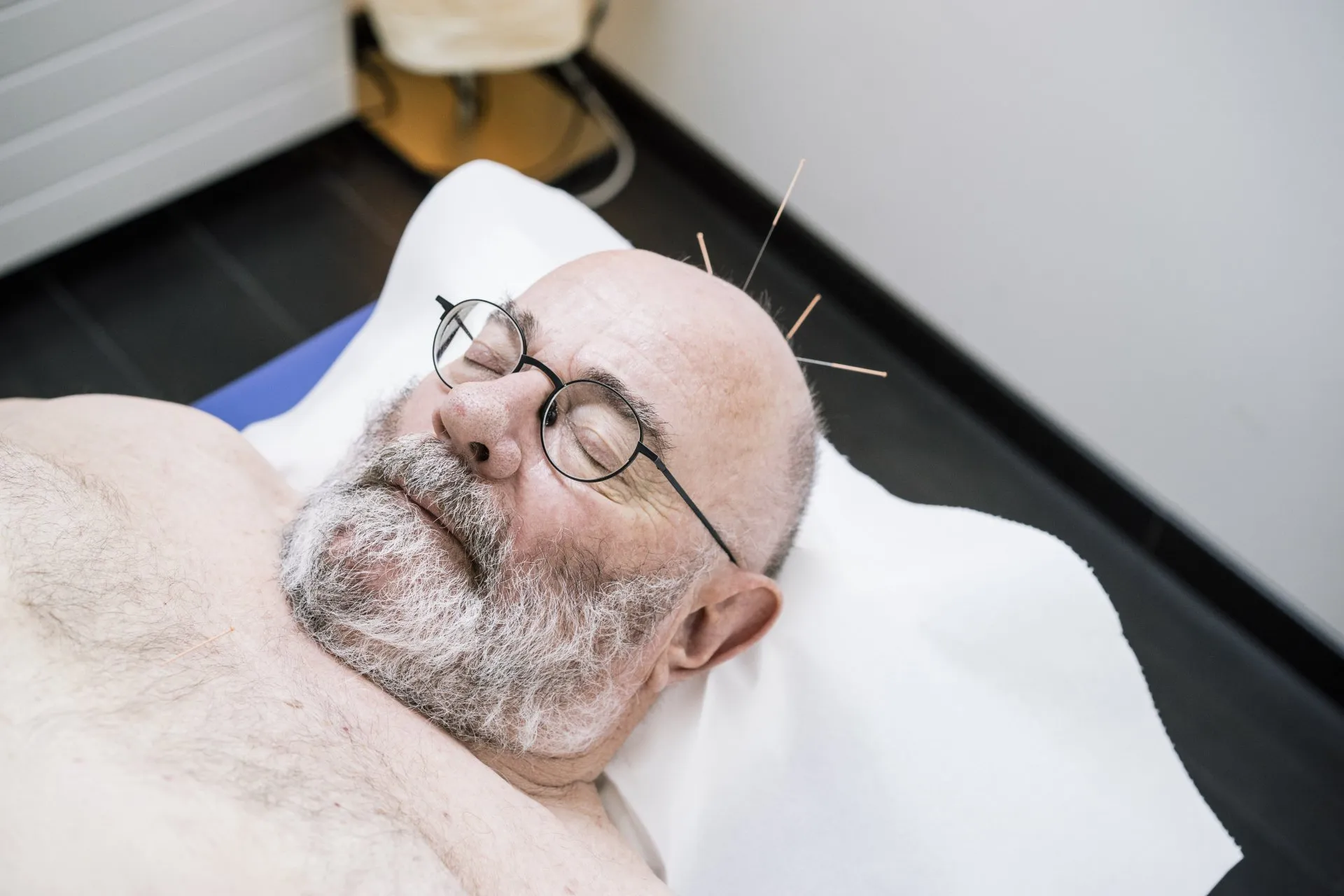 losing-weight-with-acupuncture